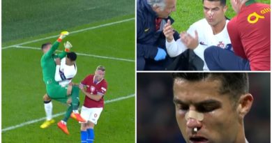 Ronaldo bê bết máu vì bị thủ môn đối phương đấm gãy mũi